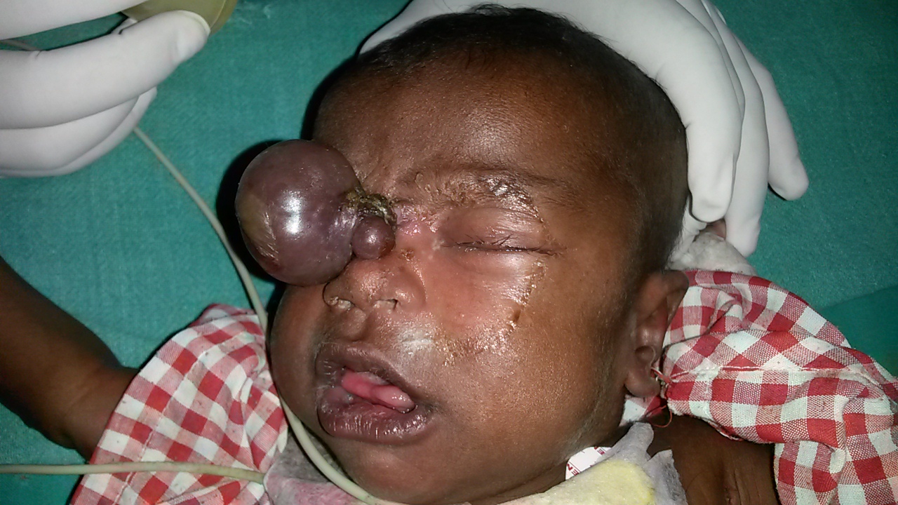 Pediatric Plastic Surgery Image 3